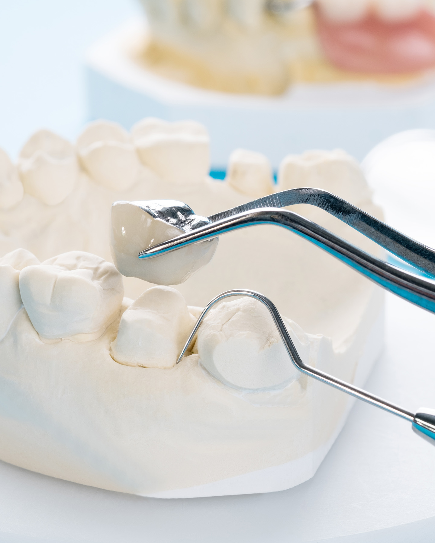 Falls Dental Care Group | Night Guards, Implant Dentistry and Root Canals