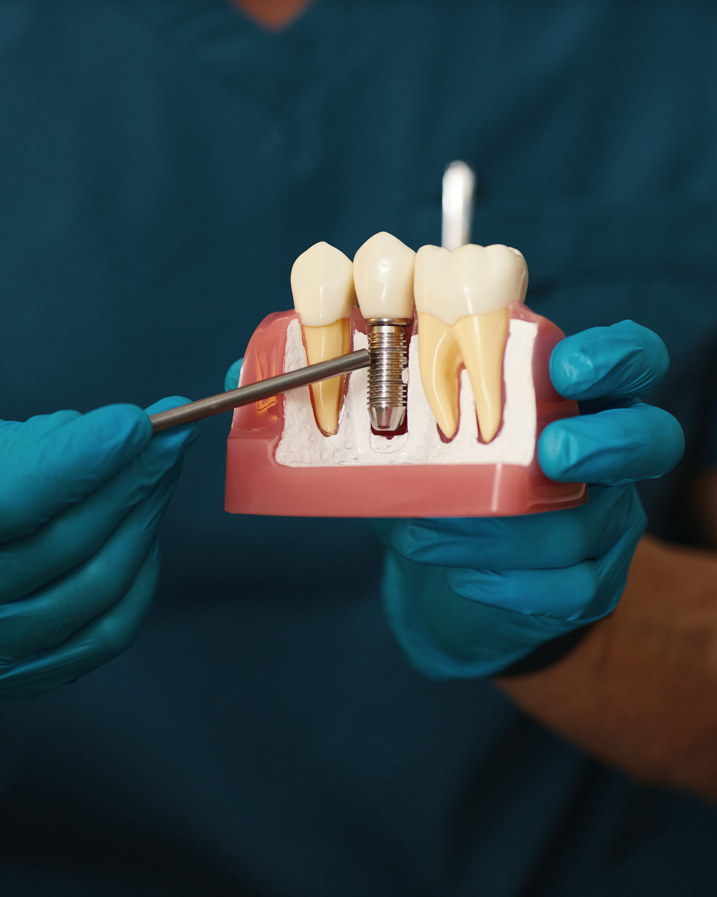 Falls Dental Care Group | Pediatric Dentistry, Veneers and Sports Mouthguards