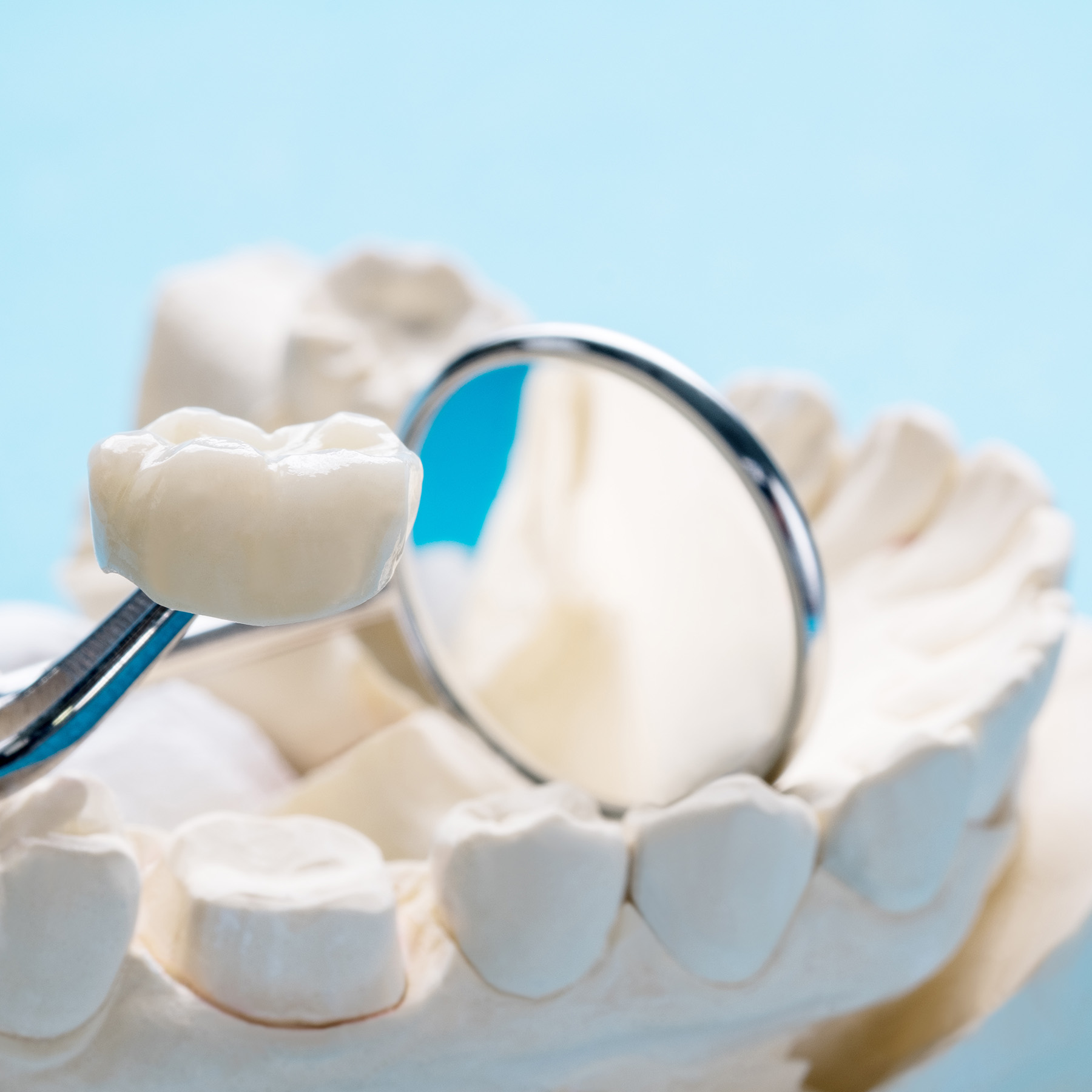 Falls Dental Care Group | Extractions, Invisalign reg and Veneers