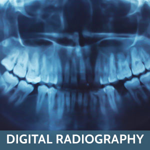 Digital Radiography